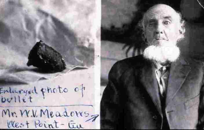 A Confederate soldier survived a head shot and spit the bullet out 58 years later