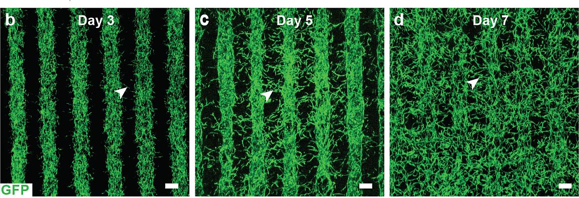 progress to cure eye conditions