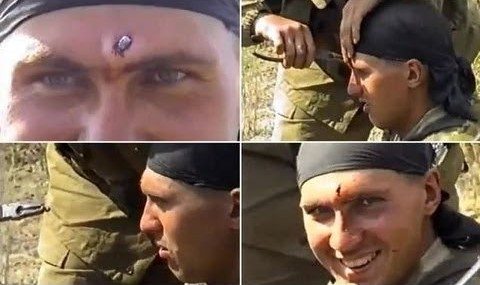 Russian soldier gets shot in the head by an AK round, sergeant pulls out the bullet