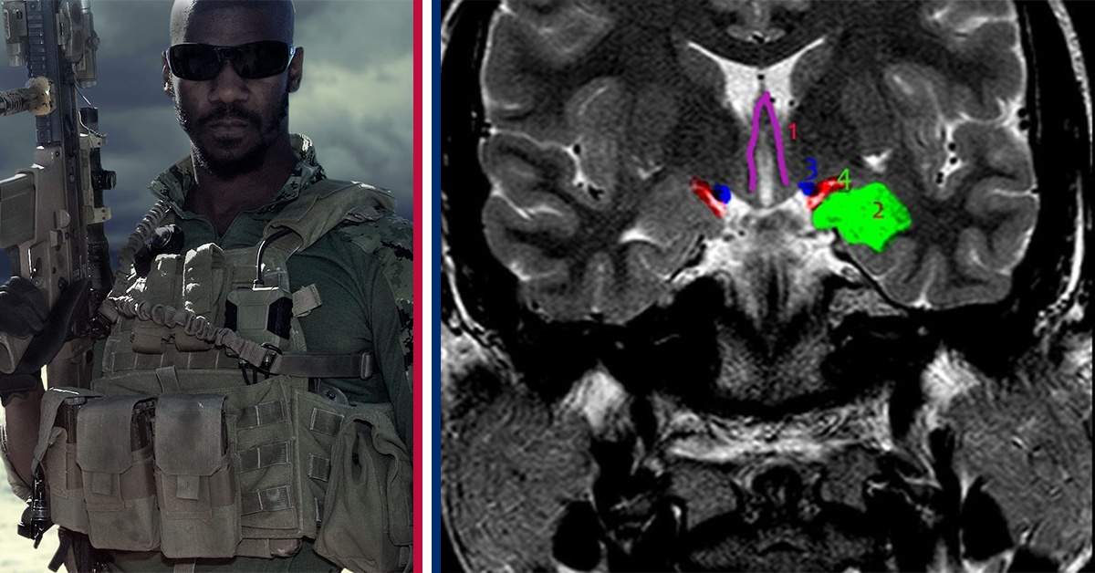 Navy SEAL brains are trained to alter how they process fear